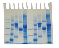 Electrophoresis of Proteins