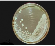 Yeast (Saccharomyces cerevisiae)